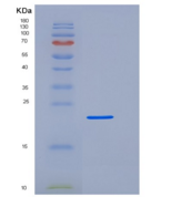人Fc γ RIIIA/FCGR3A/CD16a重组蛋白C-