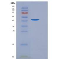人转化生长因子β受体Ⅱ(TGFbR2)重组蛋白His &Fc Tag