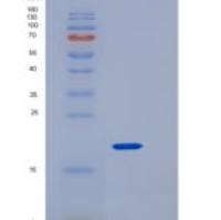 人CD4 / LEU3重组蛋白aa 1-208, His tag