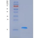 小鼠凋亡相关因子(FAS)重组蛋白His Tag