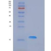 小鼠凋亡相关因子(FAS)重组蛋白His Tag