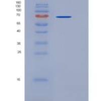 人CD4 / LEU3重组蛋白His & Fc tag