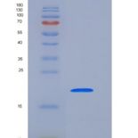 人PTH1R重组蛋白His Tag