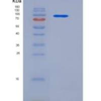 人Neuropilin-1 / NRP1重组蛋白Fc tag