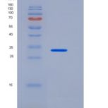 人CEACAM8 / CD66b重组蛋白His tag