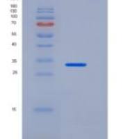 人CEACAM8 / CD66b重组蛋白His tag