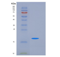 人NBL1 / DAND1 / DAN重组蛋白His tag