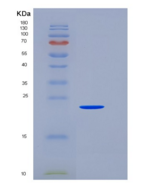 人SNAP25 / SUP重组蛋白His tag