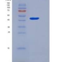 人胃内因子(GIF)重组蛋白His tag