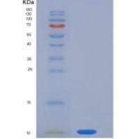 人S100P / S100E重组蛋白