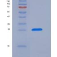 人CD89 / FCAR重组蛋白His tag