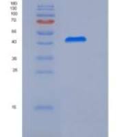 人Vaspin / SerpinA12重组蛋白His tag