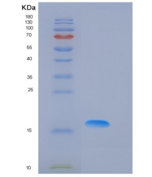 小鼠凋亡相关因子(FAS)重组蛋白His Tag