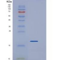 小鼠REG3D重组蛋白His tag