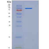 人补体成分2(C2)重组蛋白Fc tag