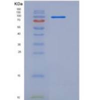 人补体成分2(C2)重组蛋白Fc tag