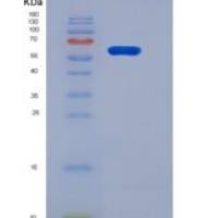 人PGRL / IGSF8重组蛋白His tag