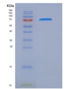 人白介素17受体C(IL17RC)重组蛋白Fc tag