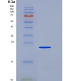 人SNAP25 / SUP重组蛋白His tag