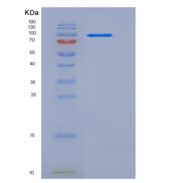 人补体成分2(C2)重组蛋白Fc tag