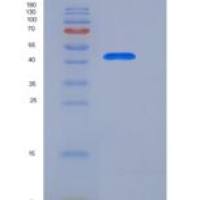 人Renin重组蛋白His tag