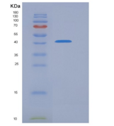 人PRMT6 / HRMT1L6重组蛋白His & FLAG