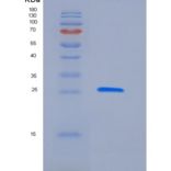 人Latexin / LXN / TCI重组蛋白His tag