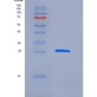 人Latexin / LXN / TCI重组蛋白His tag