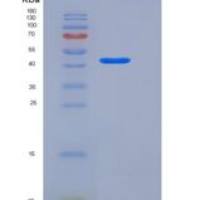 人二肽酶1(DPEP1)重组蛋白His tag