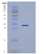 人CEACAM8 / CD66b重组蛋白His tag