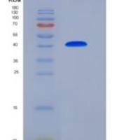 人NBL1 / DAND1 / DAN重组蛋白Fc tag