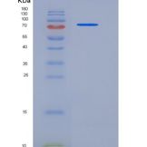 人PROS1 / Protein S重组蛋白His tag
