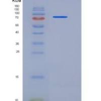 人PROS1 / Protein S重组蛋白His tag