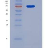 人凝血因子ⅩⅢB肽(F13B)重组蛋白His tag