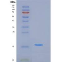 小鼠FABP4 / ALBP / A-FABP重组蛋白His & MYC Tag