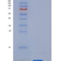 人CD3d / CD3 delta重组蛋白His tag