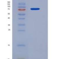 人组蛋白脱乙酰基酶3(HDAC3)重组蛋白His & GST tag