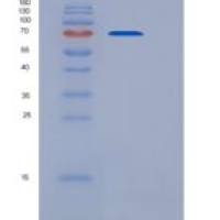 小鼠含CUB域蛋白1(CDCP1)重组蛋白His tag