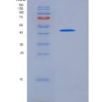 小鼠氨基酰化酶1(ACY1)重组蛋白His tag
