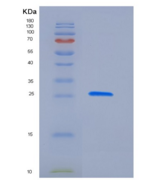 人Latexin / LXN / TCI重组蛋白His ta