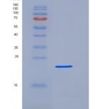 人Fc γ RIIIA/FCGR3A/CD16a重组蛋白C-6His,Val176Phe