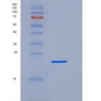 人Fc γ RIIIA/FCGR3A/CD16a重组蛋白C-6His,Val176Phe