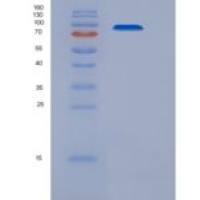 人AGO1 / Argonaute 1 / EIF2C1重组蛋白His tag