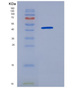 人GOLM1 / GP73重组蛋白His tag