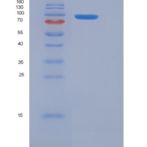 小鼠GAD65 / GAD2重组蛋白His & GST tag