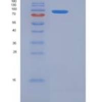 小鼠GAD65 / GAD2重组蛋白His & GST tag
