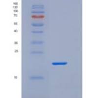 人Fc γ RIIa/FCGR2A/CD32a重组蛋白C-6His