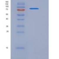 人低密度脂蛋白受体(LDLR)重组蛋白His Tag