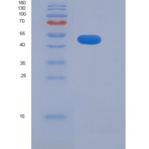 人解整合素金属蛋白酶15(ADAM15)重组蛋白His tag