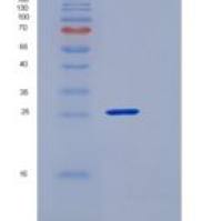 人CLEC12A / CLL-1 / DCAL2重组蛋白His tag
